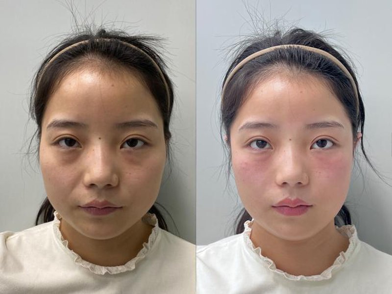 青海整形美容医院行业趋势：从传统到现代的蜕变