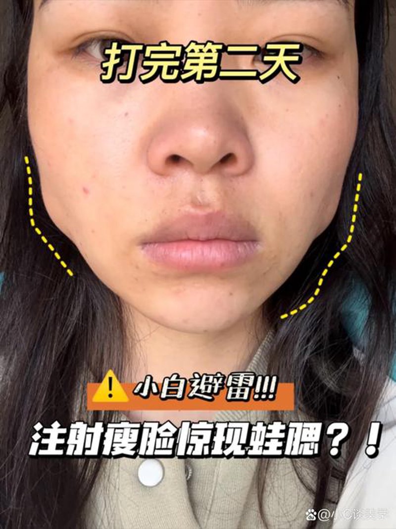 皮肤美容