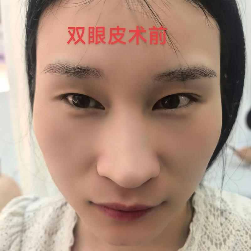 青海整形美容医院选购指南
